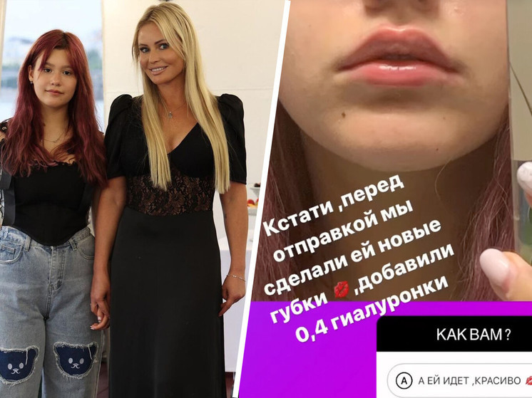 Дана Борисова разрешила 15-летней дочери увеличить губы и показала результат