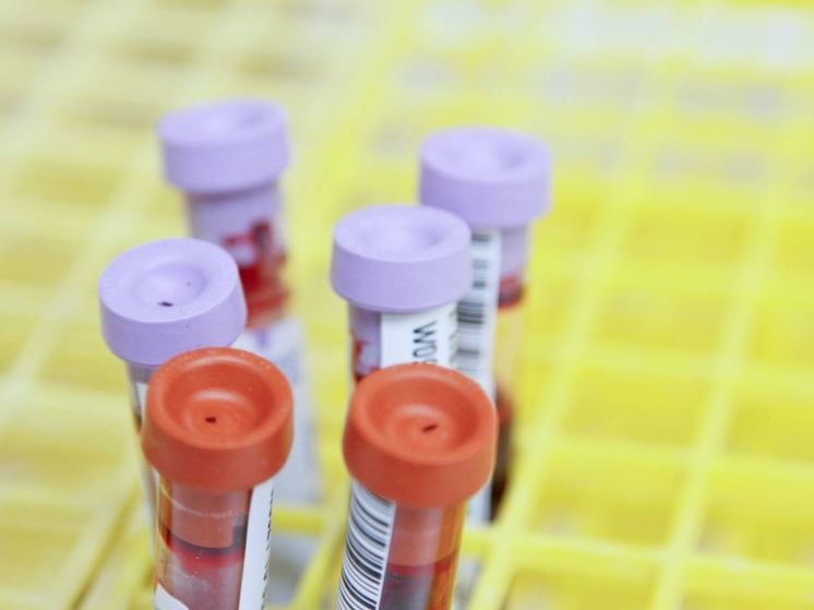 Экспресс-тестирование на ВИЧ проведут в пяти муниципалитетах Алтайского края