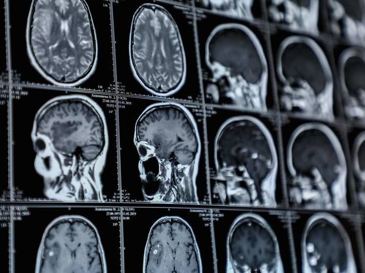 У упавшего с самоката 20-летнего волгоградца врачи обнаружили опухоль мозга