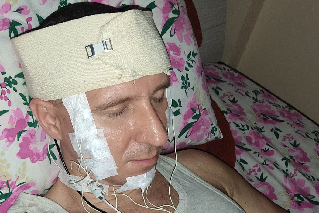 Self-taught Mikhail Raduga implanted in his head 