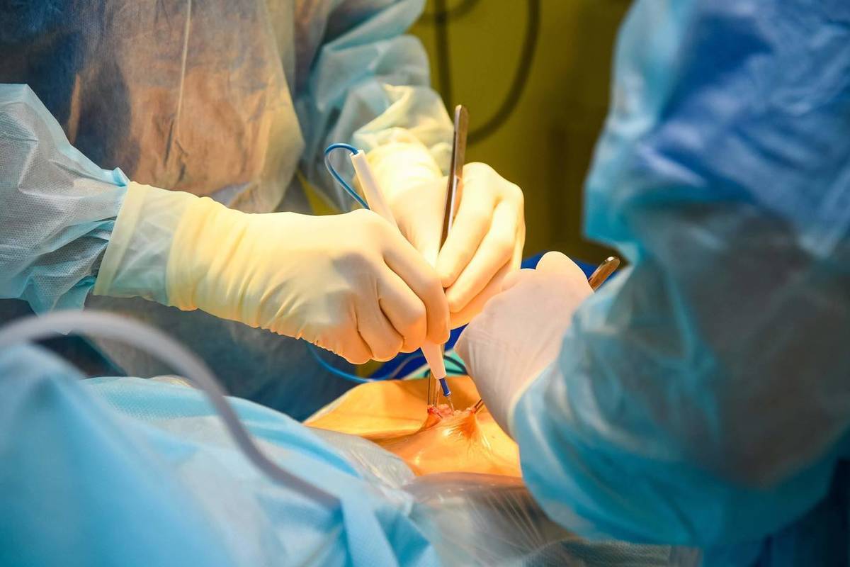 Волгоградские врачи спасли пенсионерку с аневризмой брюшной аорты