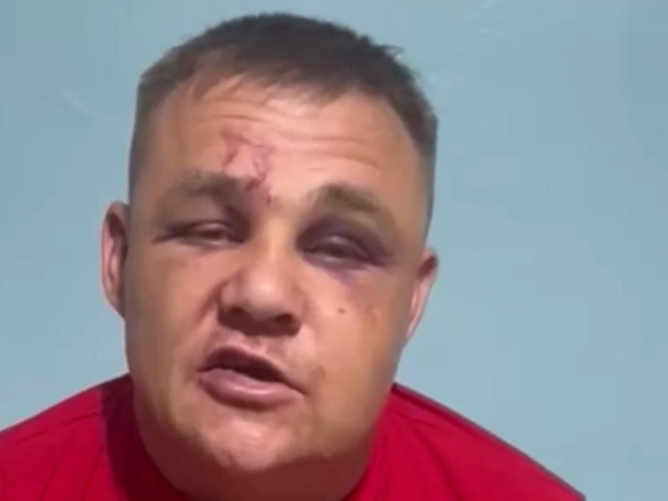 Избитый в Забайкалье ветеран СВО призвал в видеообращении не устраивать самосуд над виновными