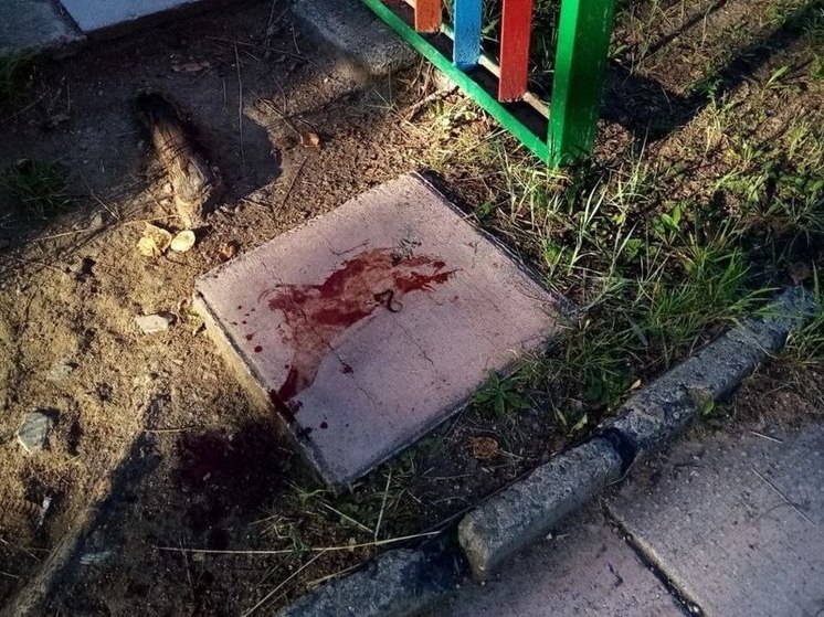 Сотрудник детсада разбила лоб на территории учреждения в Краснокаменске