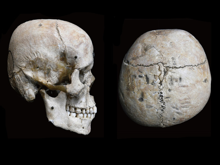 Разгадана загадка деформированных черепов из древнего захоронения