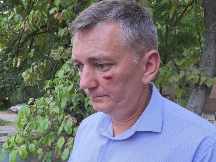 В Курске неизвестный в маске напал на директора управляющей компании