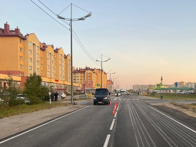 В Новом Уренгое подросток на электросамокате врезался в машину и попал в больницу