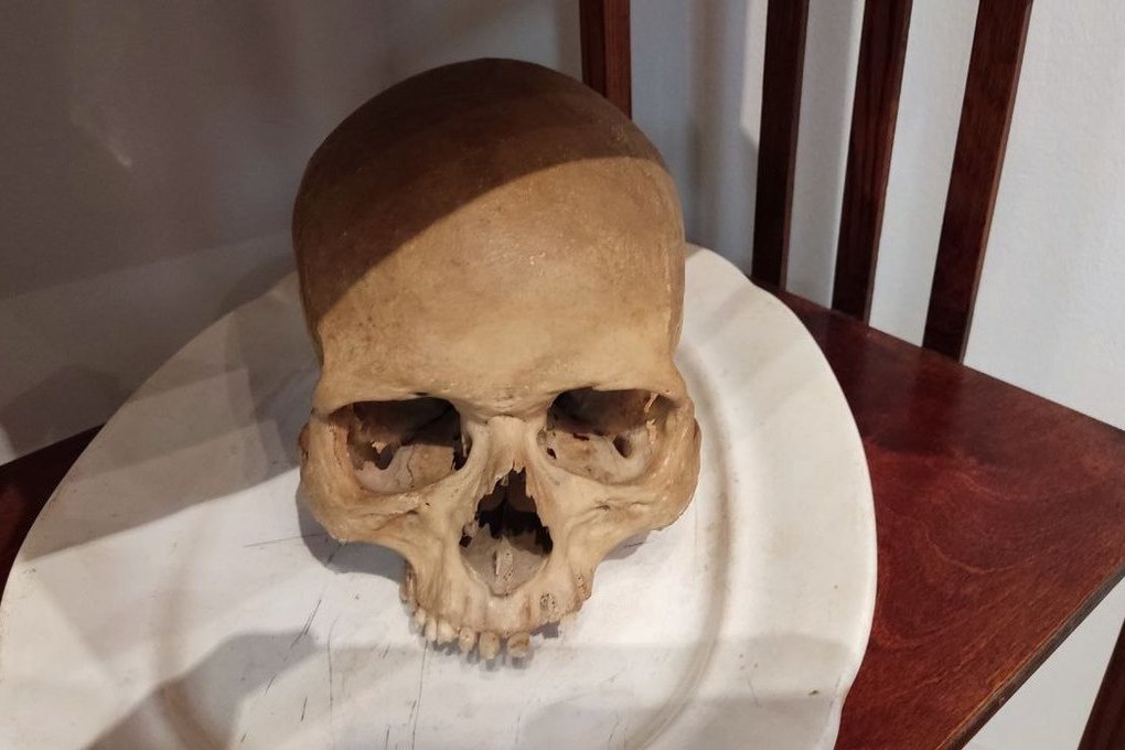 Человеческий череп нашли в лесу под Гатчиной