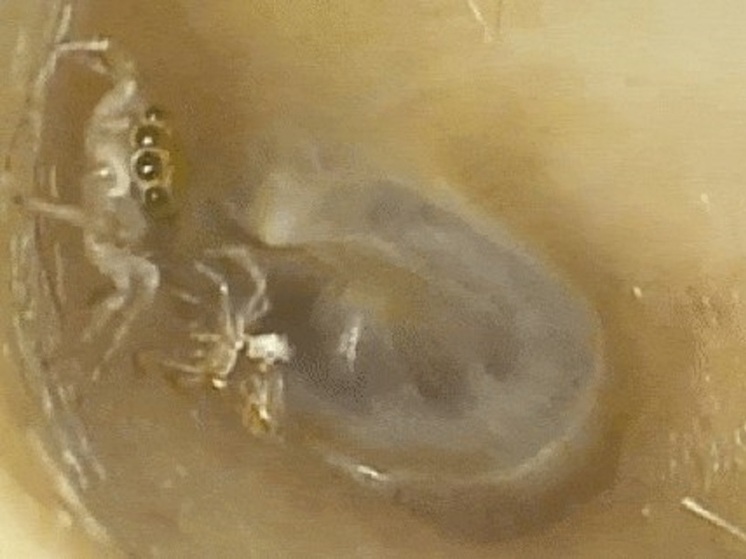 В ухе жительницы Тайваня поселился и полинял паук