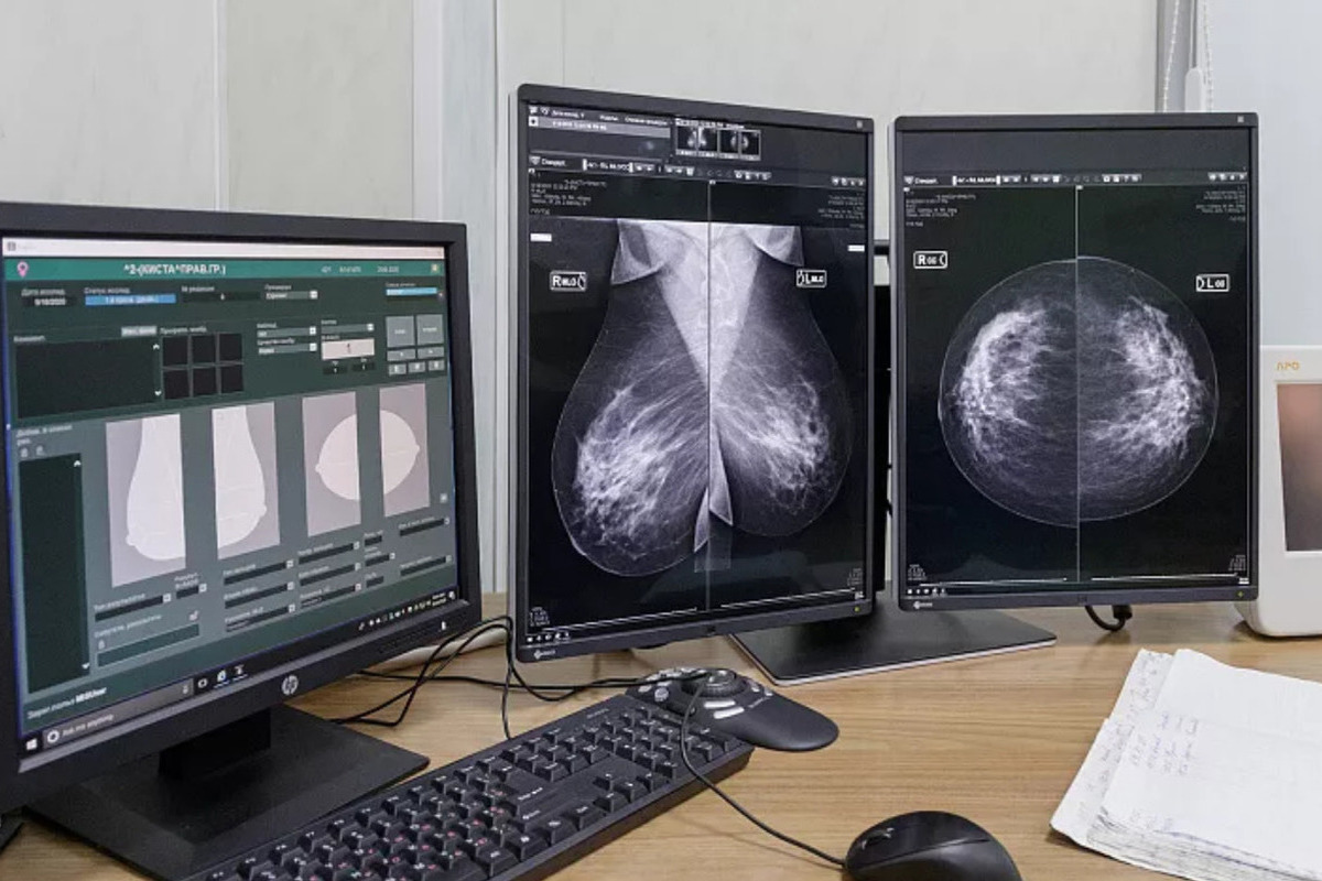 В Туле свыше 900 женщин прошли маммографию в поликлинике онкодиспансера