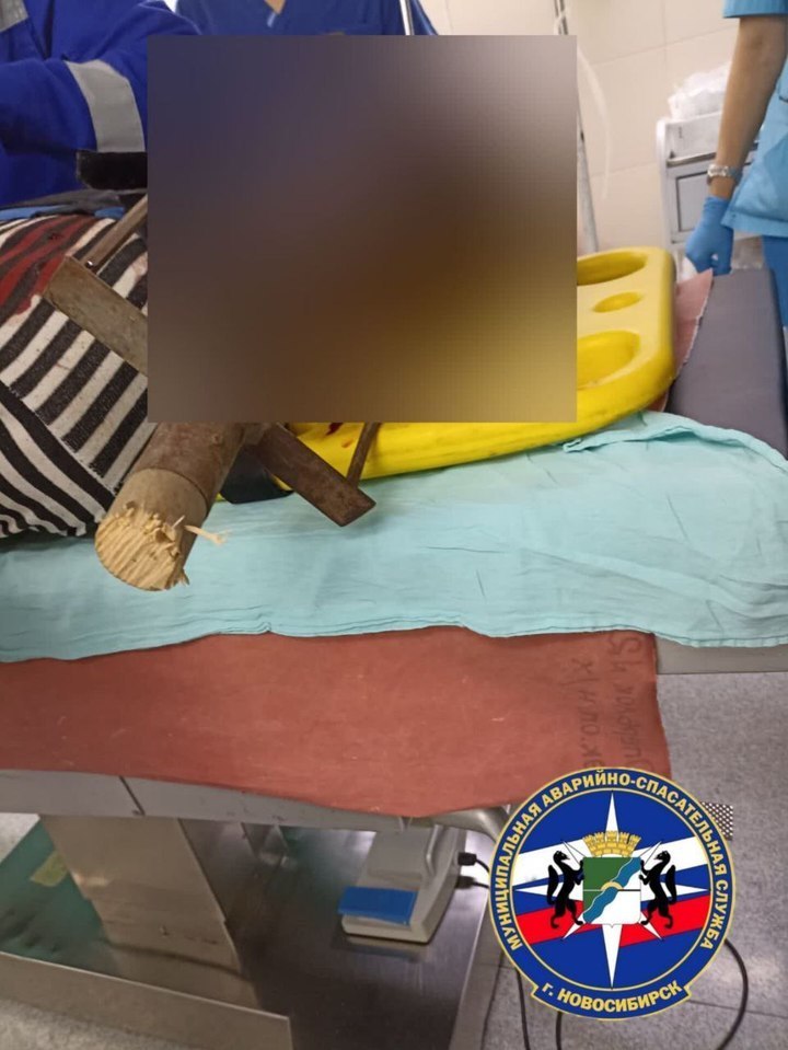 В Новосибирске спасатели вытаскивали вилы из головы мужчины В операционную