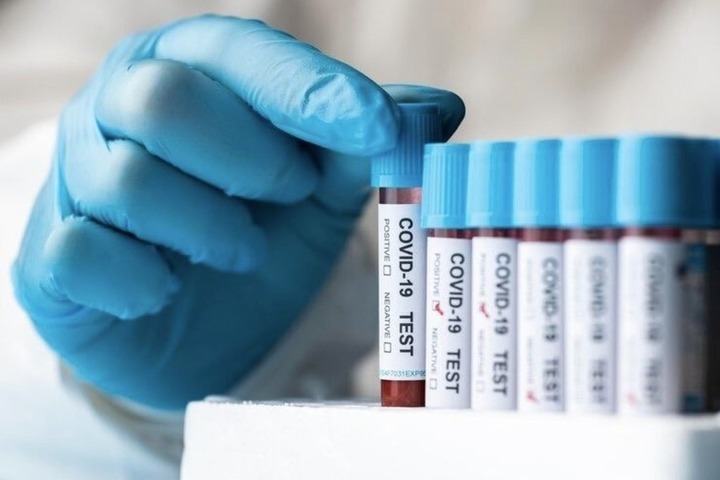 Заболеваемость коронавирусом в Марий Эл выросла на 14,6%