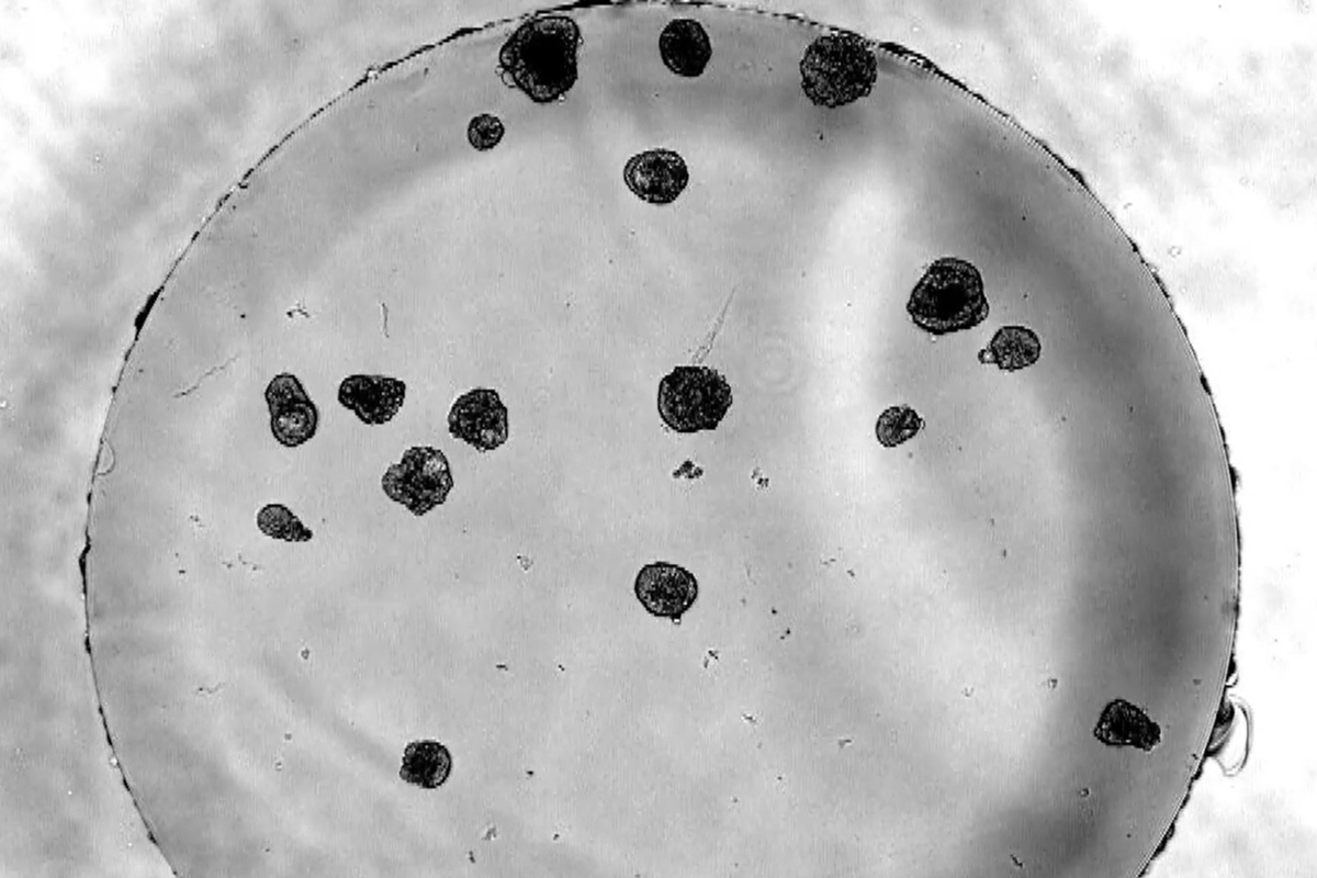 Tiny living robots made from human cells surprised scientists