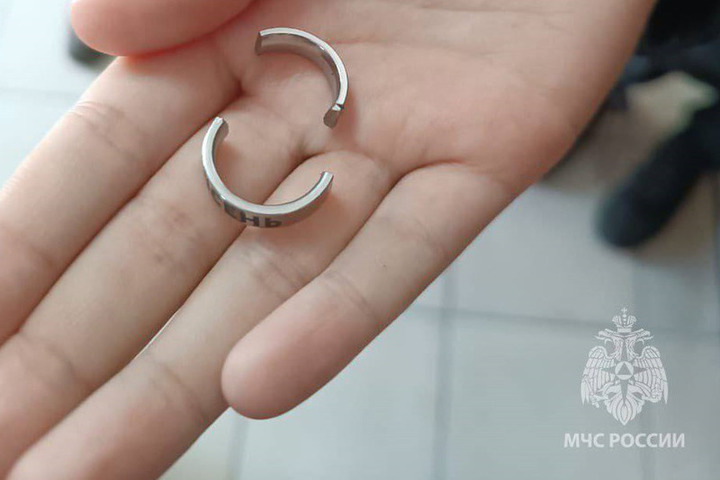 В Зеленоградске спасатели с помощью бормашины сняли кольцо с пальца девочки