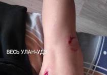Сегодня, 4 декабря, в поселке Онохой  Заиграевского района Республики Бурятия на 11-летнюю девочку напали четыре собаки
