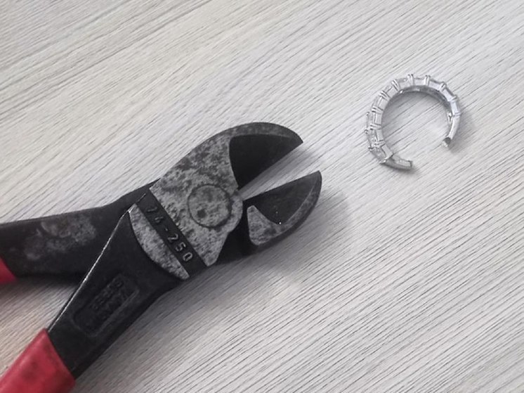 Жительнице Мытищ пришлось вызвать спасателей, чтобы снять кольцо