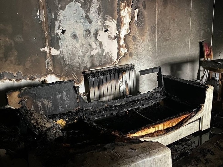 Житель Томского района получил ожоги рук и ног во время пожара в доме