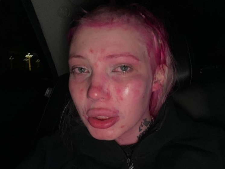 Побритую в Ереване российскую блогершу задержали за хулиганство