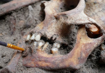 Древние скандинавы умели обращаться с зубной болью
