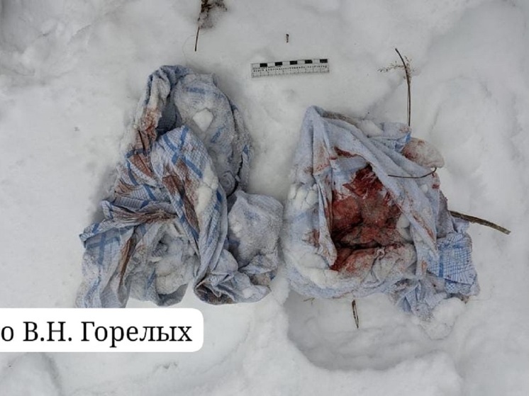 Новорожденный, найденный в сугробе на Урале, в тяжелом состоянии