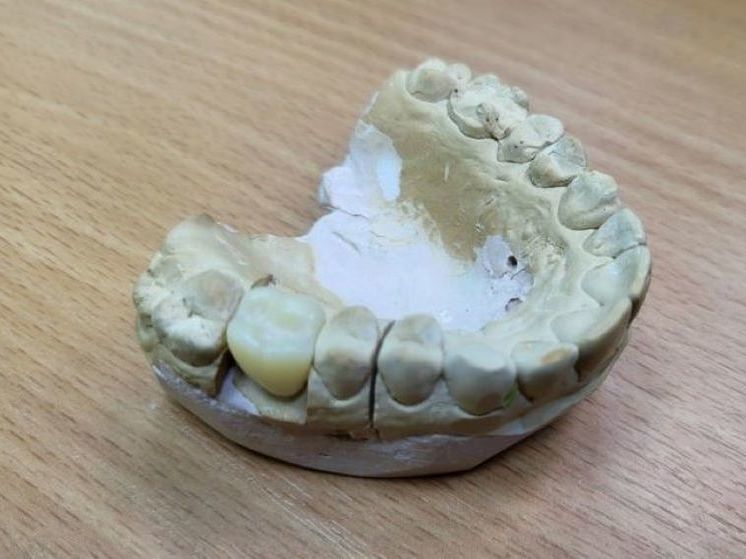 Уфимские врачи изготавливают зубные протезы с помощью искусственного интеллекта