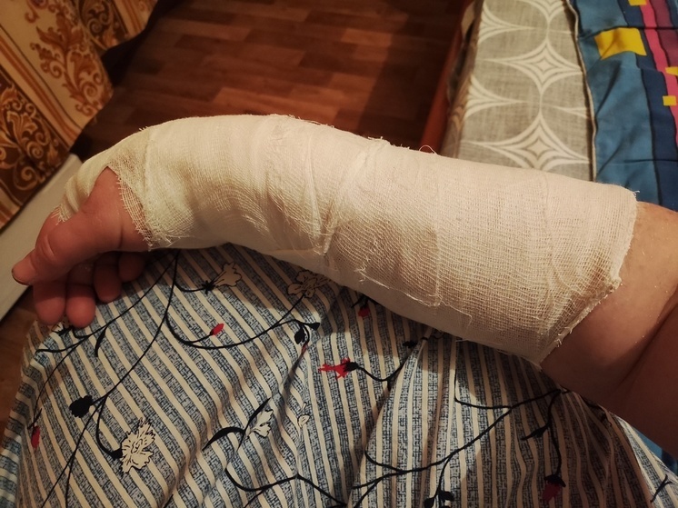 Мужчина со сломанной рукой пригласил администрацию Петрозаводска в травмпункт