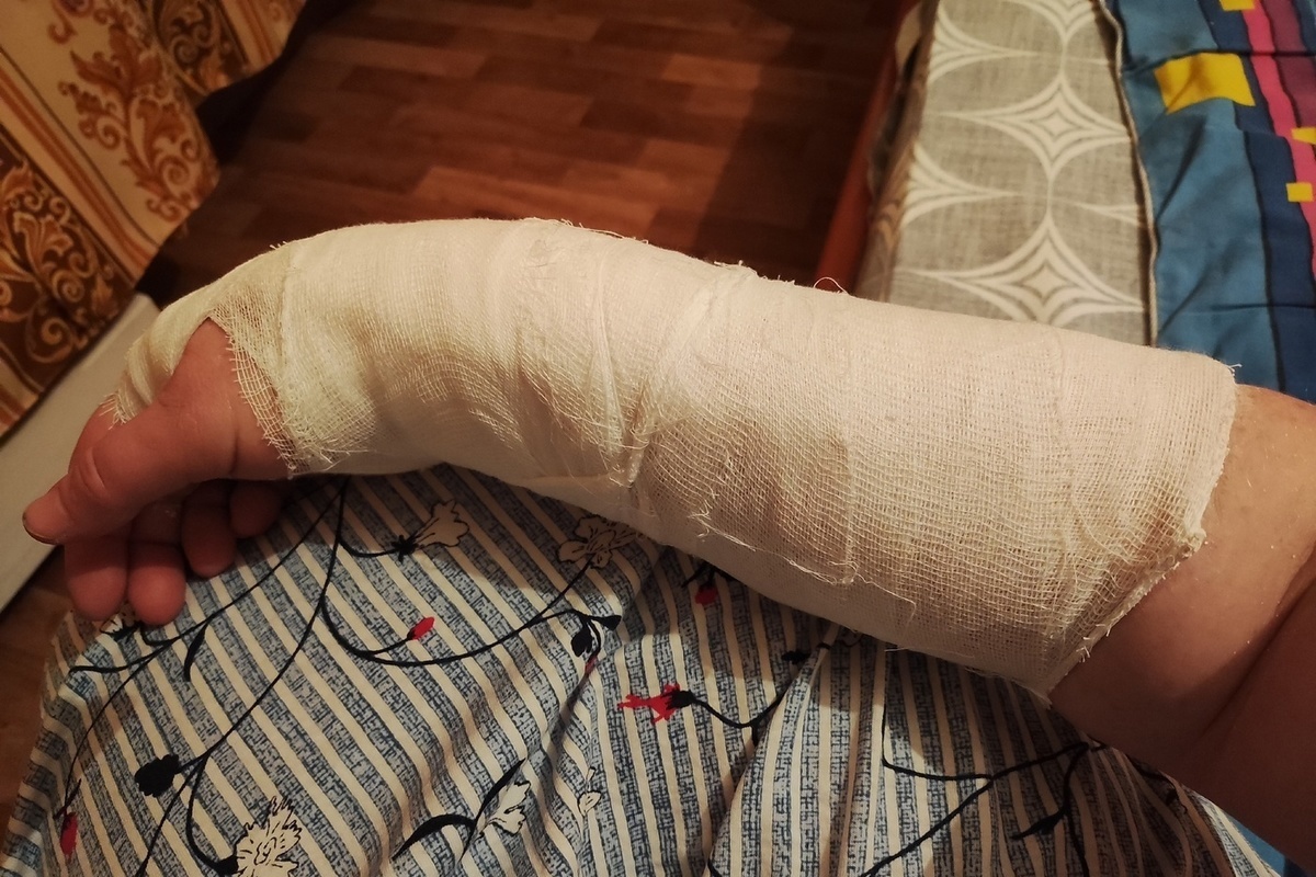Мужчина со сломанной рукой пригласил администрацию Петрозаводска в травмпункт