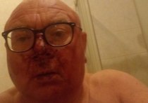 56-летний российский тележурналист Павел Лобков был жестоко избит минувшей ночью в центре Москвы