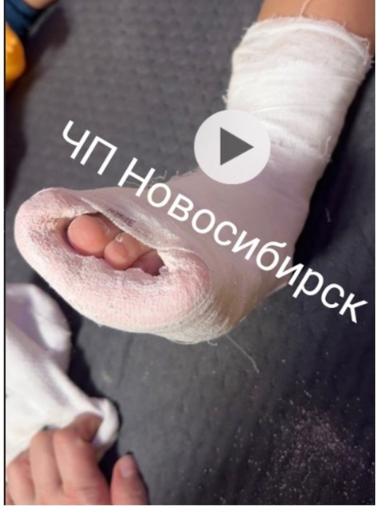 Двухлетний мальчик сломал ногу игровой ТЦ Новосибирска