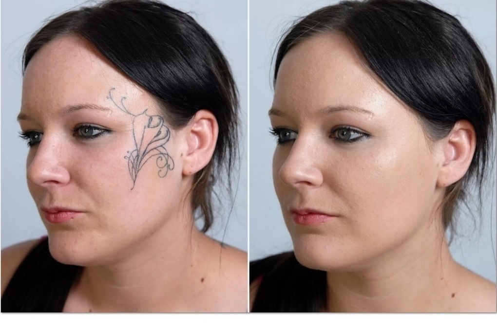 Как скрыть татуировки с помощью макияжа