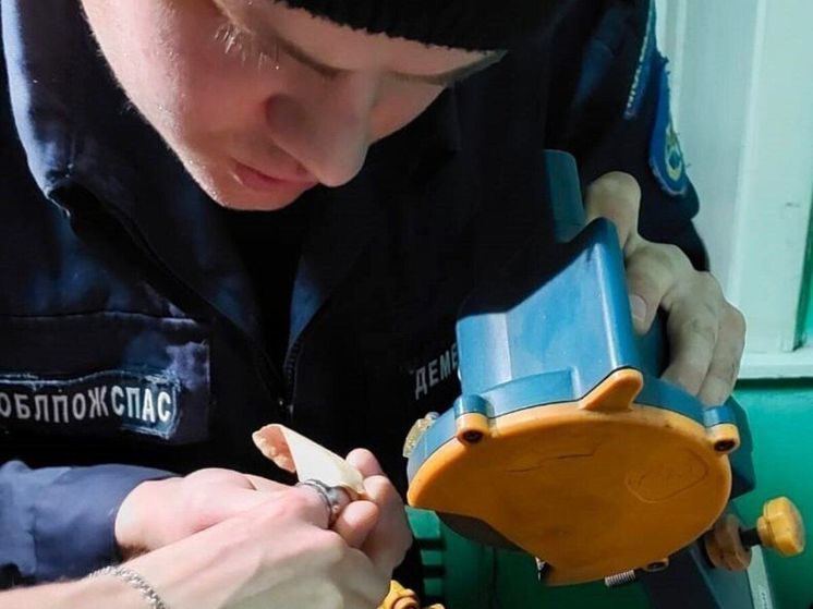 Жительница региона смогла снять кольцо только благодаря спасателям