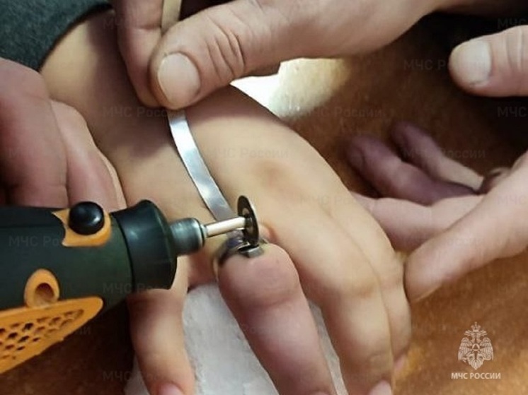 В Орле спасатели сохранили ребенку палец, на котором застряло кольцо