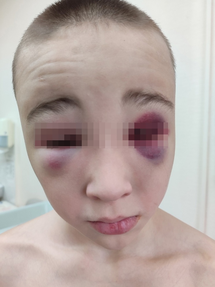 Жительница Новосибирска заявила о побоях 10-летнего сына в военном центре