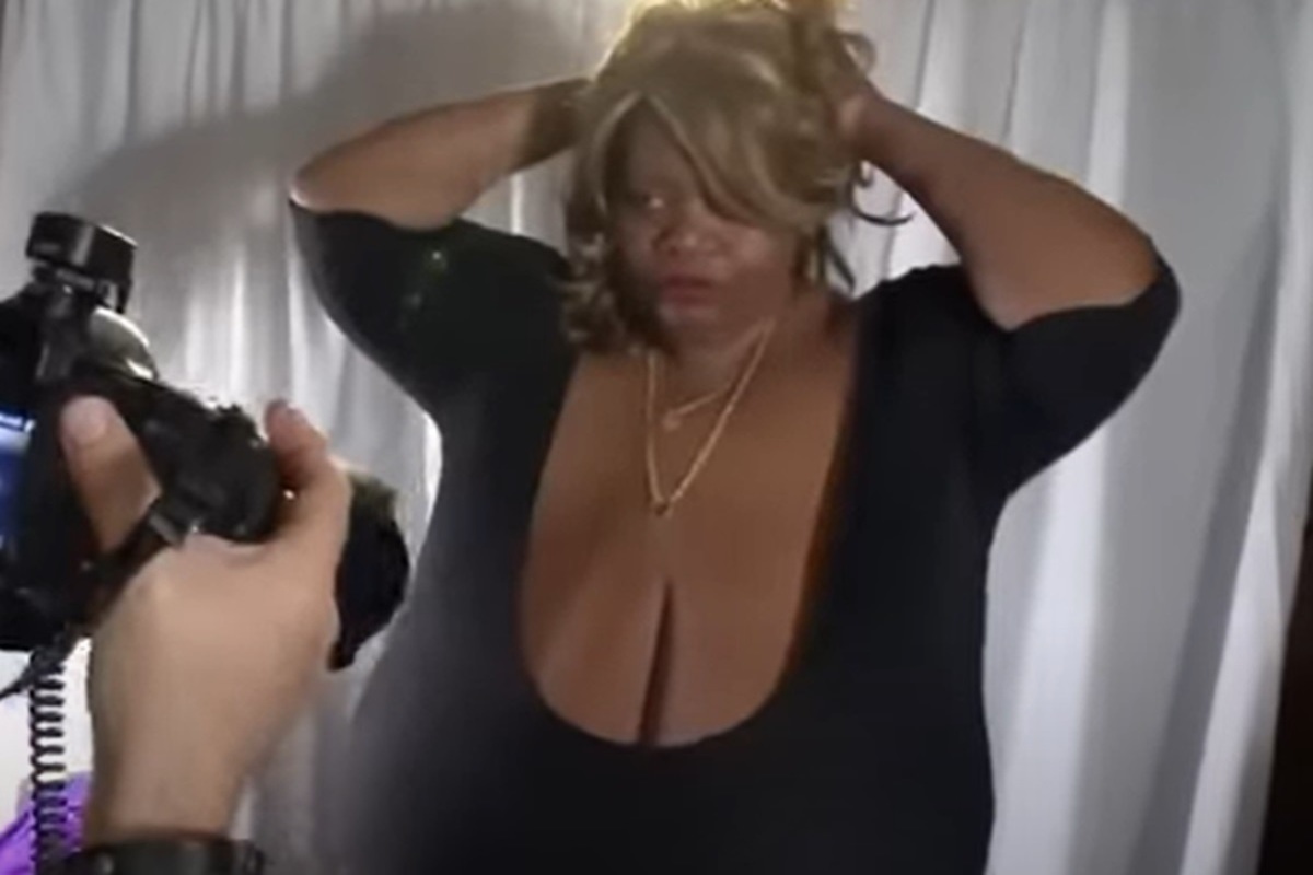 An American woman spoke about the difficult life with the largest breasts in the world