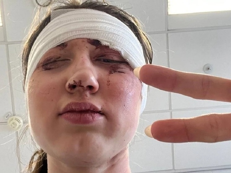 Томская лыжница пострадала в массовом завале во время гонки в Сочи