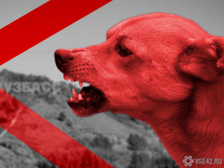 В Новокузнецке организована проверка по факту нападения собаки на ребенка