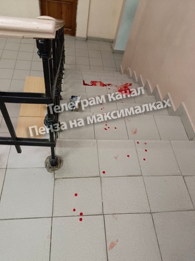 Пензенский Следком взялся за дело о травмировании ребенка в школе