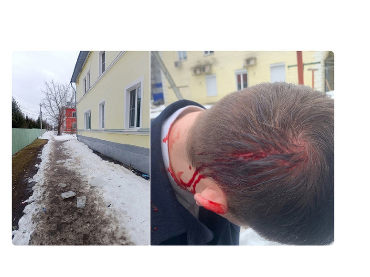 В Рыбинске упавшая льдина пробила голову курсанту