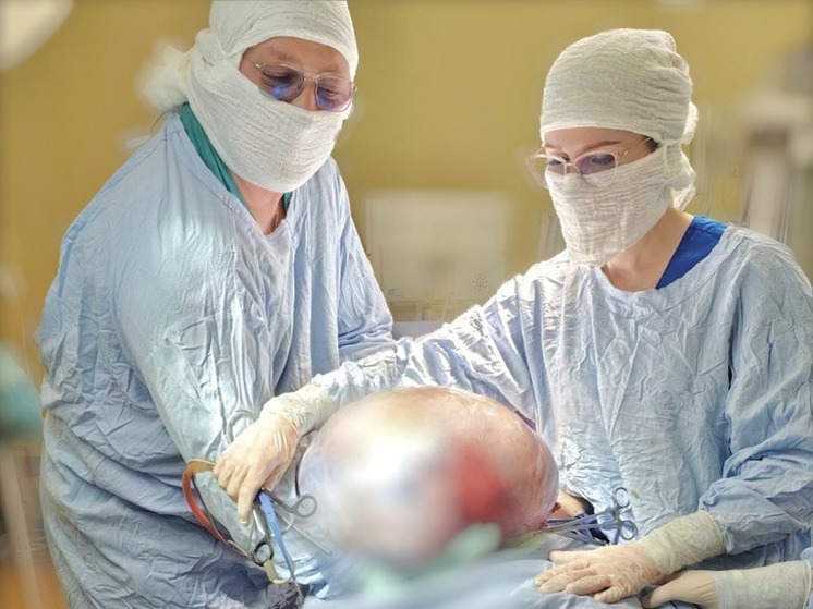 В Сургуте врачи удалили женщине гигантскую опухоль яичника