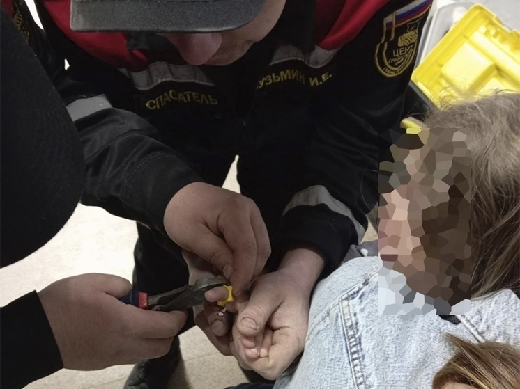 В Костроме 4-летней малышке кольцо с пальца пришлось снимать спасателям