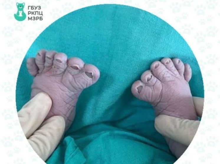 Уфимка родила третьего ребенка с лишними пальчиками на ножках