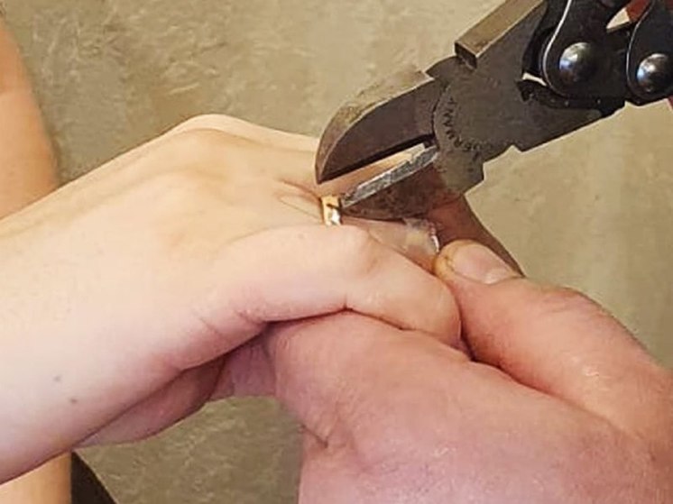 Девушке пришлось вызвать спасателей, чтобы снять обручальное кольцо