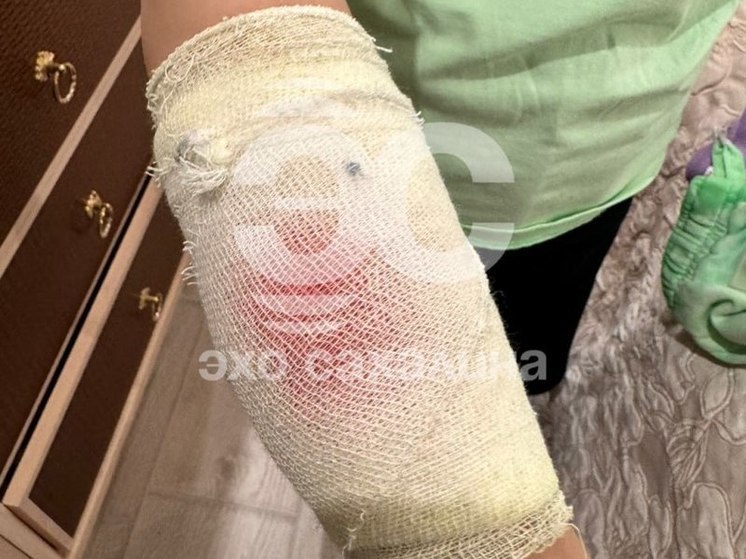 В Южно-Сахалинске девочку покусала собака, которую выгуливали без намордника