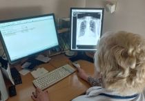 В районных больницах установят современные цифровые рентгеновских аппараты