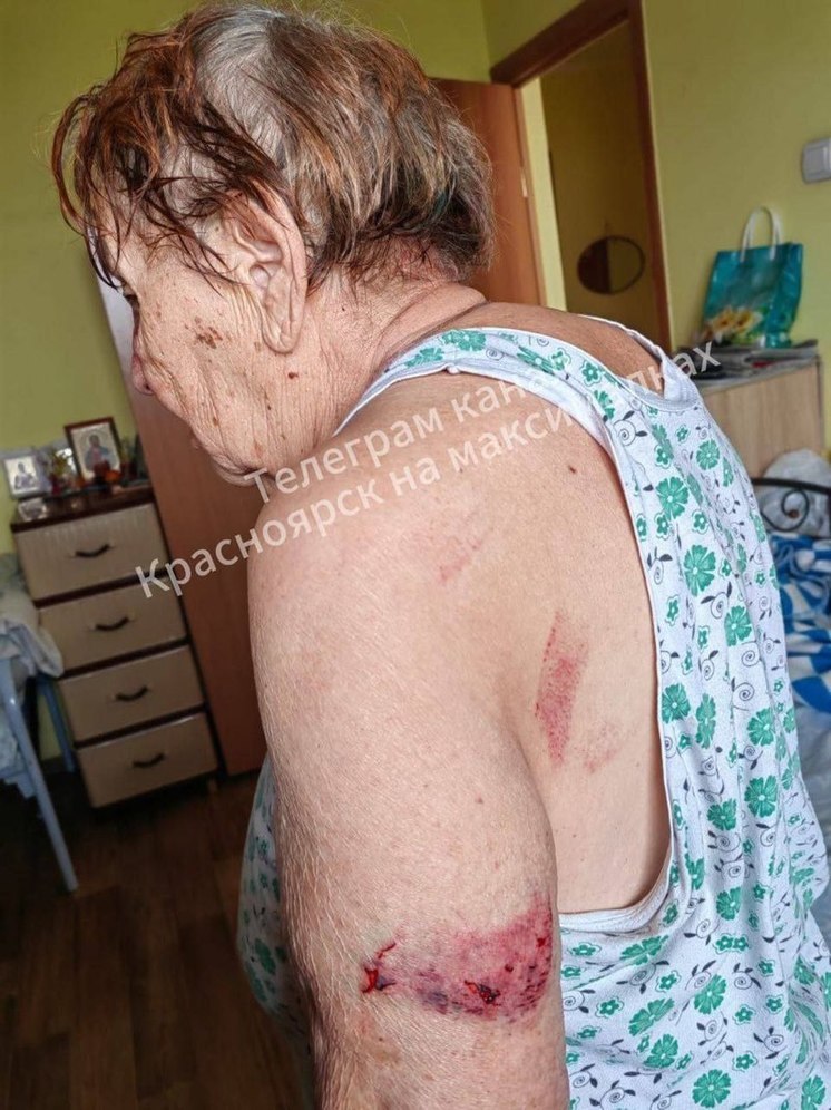 В красноярском пансионате избили женщину-ветерана