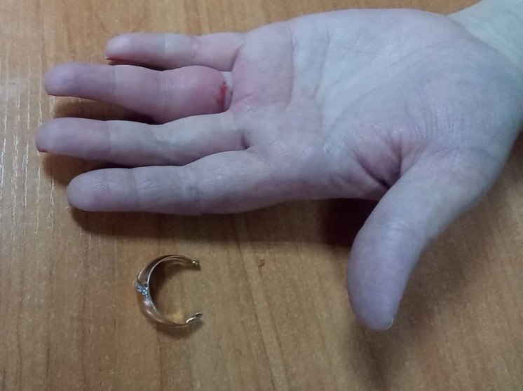 Спасатели МАСС помогли двум женщинам снять кольца с опухших пальцев в Новосибирске
