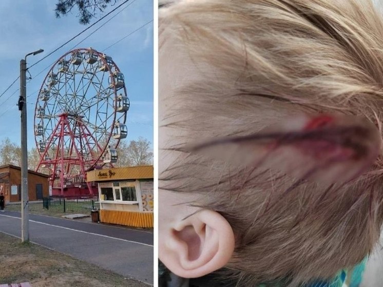 Ребенок пострадал в результате столкновения с электросамокатом в Ангарске