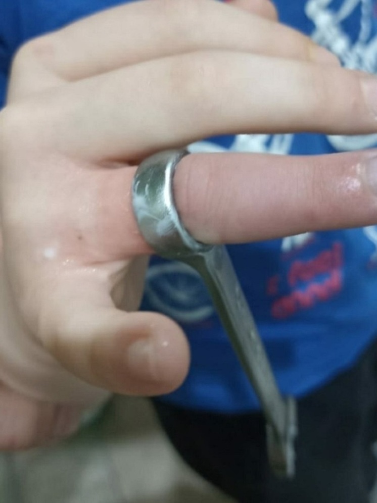 Костромским спасателям пришлось вызволять палец 9-летнего ребенка от гаечного ключа