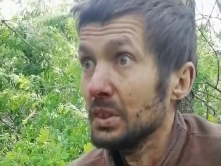 Соцсети: украинский солдат очнулся в плену со взглядом «на тысячу ярдов»