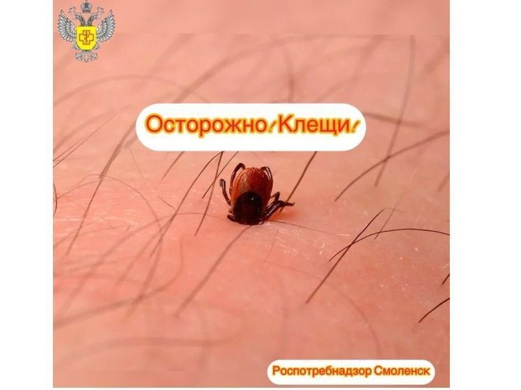 На Смоленщине за неделю клещи покусали 99 человек