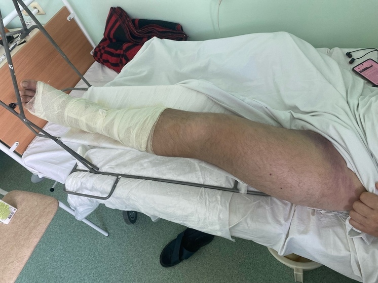 Жителя Устюженского округа госпитализировали после укуса змеи